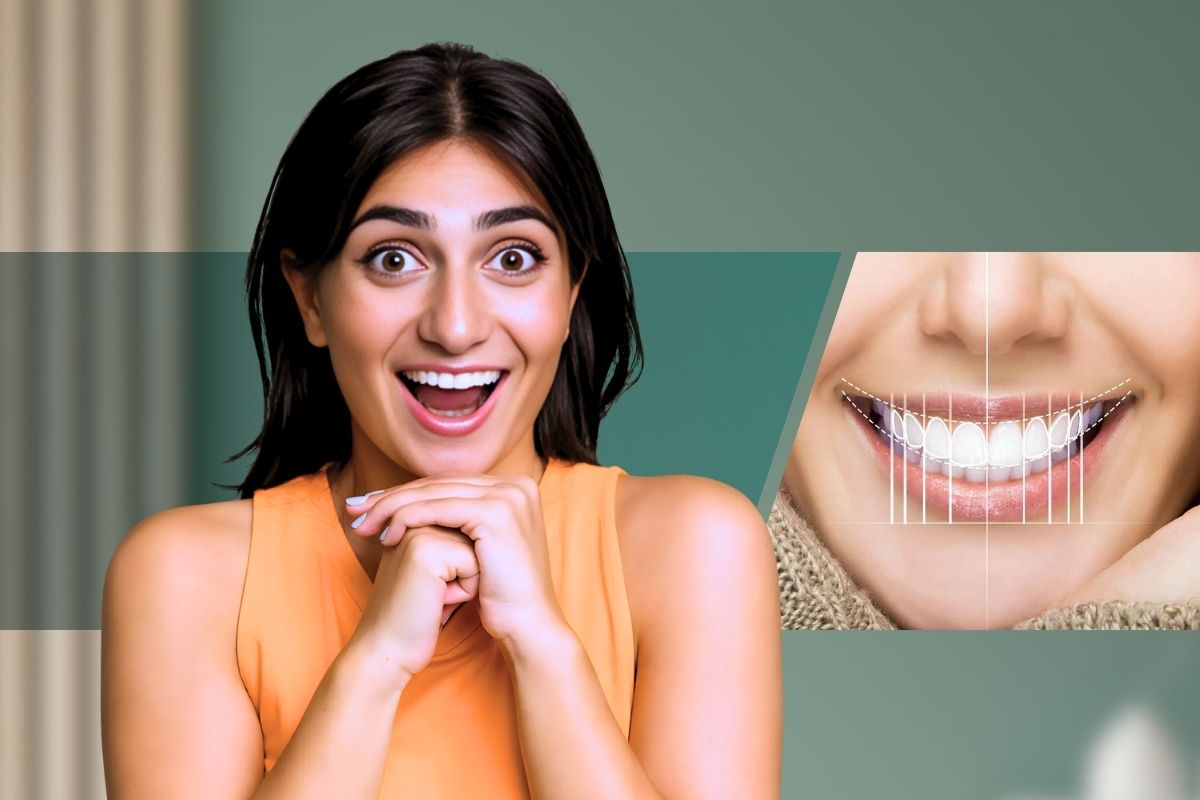 Smile Makeovers